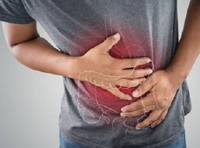 Make lifestyle changes to counter Ulcerative Colitis